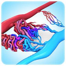 Arteriovenous Malformations