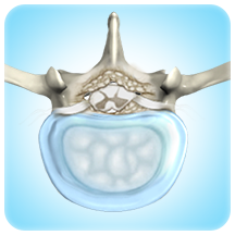 Degenerative Spinal Conditions