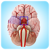 Pituitary (including difficult revisional/ previously operated patients)