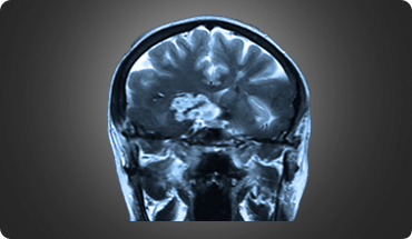 Mr. Kumar Abhinav img