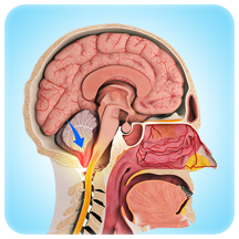 Skull Base Meningiomas